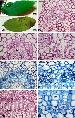 The Native Hymenoscyphus albidus and the Invasive Hymenoscyphus fraxineus Are Similar in Their Necrotrophic Growth Phase in Ash Leaves